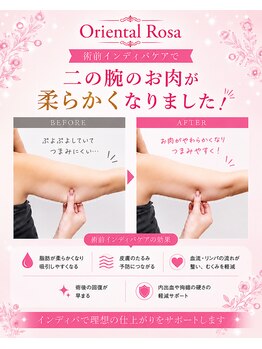 オリエンタルローザ 表参道(Oriental Rosa)/術前インディバケア大人気です！