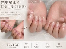 ビベリー(BEVERY)の雰囲気(お問い合わせは◆LINE検索【@446nrwne】)