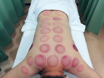 たくみ整体院/【竹吸玉】施術における残色色体