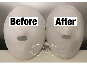 美極 トータルビューティー(美極 TOTAL BEAUTY)/恵比寿/小顔コルギ/エステ/