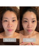 グレースフィオーレ 上野御徒町店(gracefiore)/ビフォーアフター