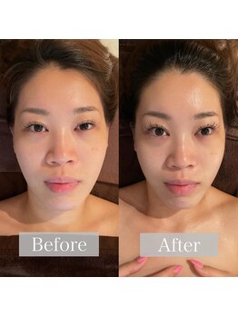 グレースフィオーレ 上野御徒町店(gracefiore)/ビフォーアフター