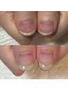 自爪育成ジェルネイルの施術
