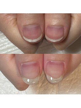 キュア(Cure.)/自爪育成ジェルネイルの施術