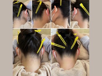 シェノン(chainon)/Before/After 【うなじwax】