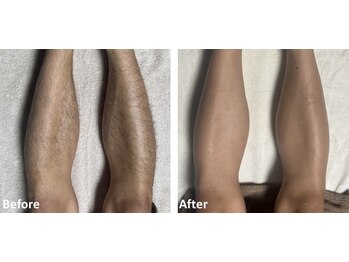 アールイー(Re:)/