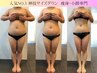 【人気No.1】-5kgを目指す！サイズダウン3ヶ月集中ケア120分¥55,900→¥19,800
