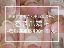 メイシンネイル(Meixingnail)/看護師さん支持多数巻爪矯正