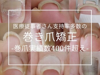 メイシンネイル(Meixingnail)/看護師さん支持多数巻爪矯正
