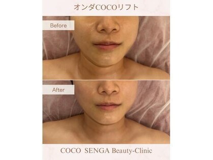 ココセンガビューティークリニック 恵比寿(COCO SENGA Beauty-Clinic)の写真