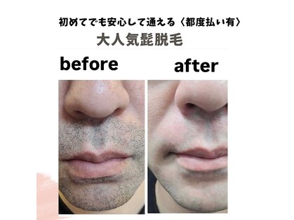 やどかりの写真