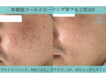 リメイク 広尾(REMAKE)/