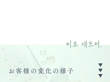 イロハ(IROHA)/ハーブピーリング/小顔/毛穴