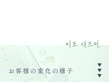 イロハ(IROHA)/ハーブピーリング/小顔/毛穴