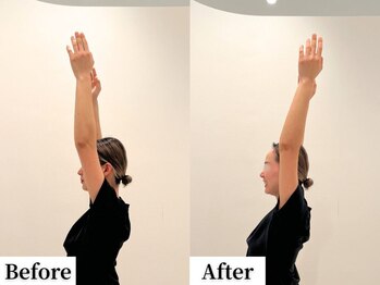 ソレア(Solea)/肩こり・巻き肩改善1回目