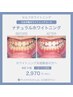 【新規様限定♪】ナチュラルホワイトニング 10分照射3回 合計30分 2970円