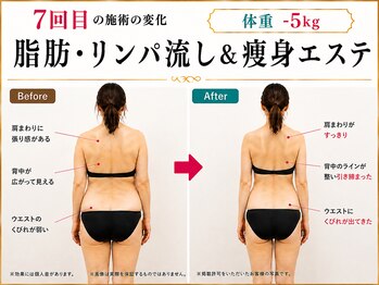 美宝 鈴蘭台の写真/くびれが欲しいならコレ！ぽっこりお腹・浮き輪肉を本気で変える結果重視・痩身Wコース＜脂肪燃焼120分>