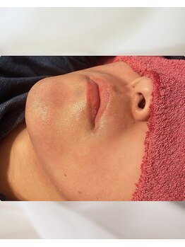 アエラ(AERA)の写真/メンズ毛穴ケアしたい男性へ！フェイシャル脱毛・エステで清潔感アップを目指そう☆