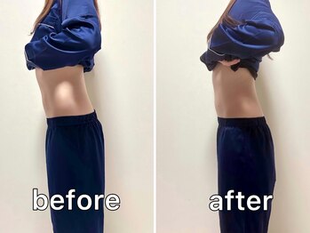 サンク(Cinq)/【腸もみ+整体】反り腰改善