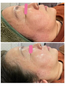 カラダ専家 恵びす(KARADA専家)/結果出しにこだわる美肌メニュー