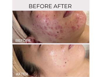 トット 恵比寿(totto)/ケア症例