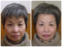 ナチュライズ(NatuRise)/くま改善