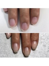 トレフル(Trefle)/自爪育成/同じ方の変化です