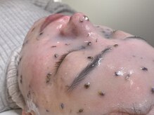 ニコ(nico…)/フェイワックス後の鎮静