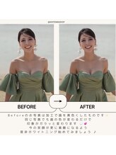 ホワイトニングショップ 船橋店/ホワイトニング専門店 船橋