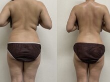 ビューティコア 二子玉川/何をしても痩せない貴方に