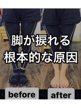 カワル整体 上通り院/脚が捩れる根本的な原因