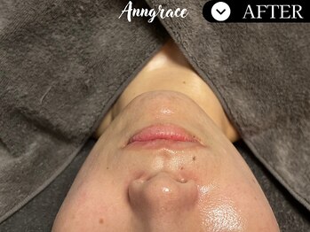 アングレイス(Anngrace)/【ポールシェリー】/After