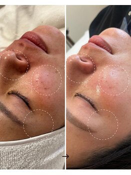 サロン モジョ(mojo)/ポテンツァ