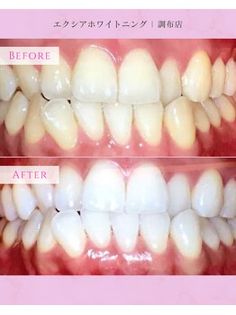 エクシアホワイトニング 調布店/30代男性会員様/奥様も大絶賛!