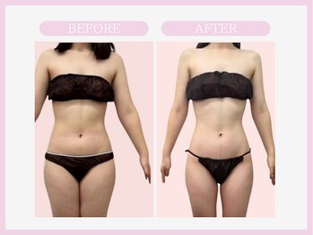 アコガレコガオ 青森店/