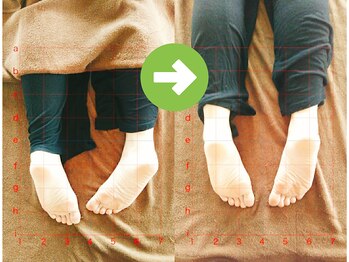 サプライズ整体院/20代ママの初回産後の骨盤矯正