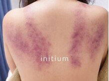 イニティウム 清澄白河(initium)/【スライドカッピング】