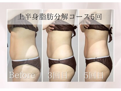 ミア(miiia)の写真