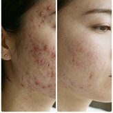 マイスタイル(My style Beauty)