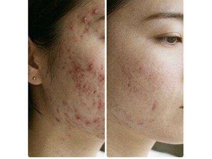 マイスタイル(My style Beauty)の写真