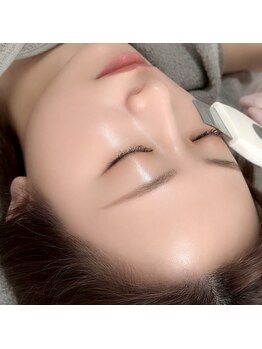 ストーリー(STORY)の写真/【毛穴レス&なめらか肌】毛穴洗浄とフェイシャルワックスでお肌のキメを徹底改善★透明感のあるお肌へ♪