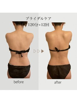 ファミーユ 名古屋店/【ブライダルケア】背中ケア