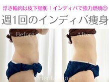 オリエンタルローザ 表参道(Oriental Rosa)/万能効果のインディバボディ！！