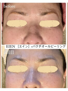 ザ エステティック福岡/お肌もむくみも◎