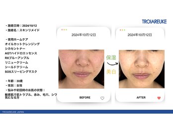 リトルーム(Litroom: from Seoul)/スキンメイド