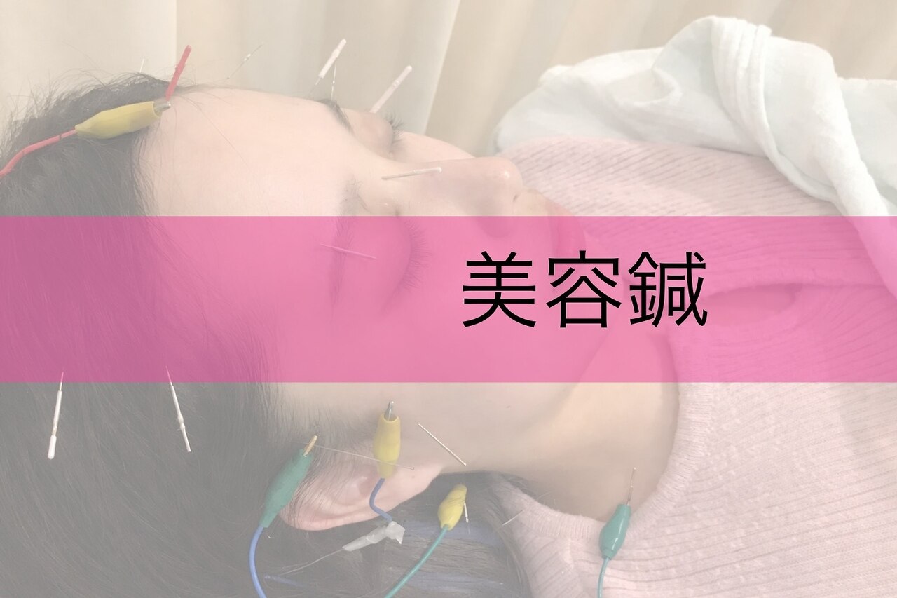 【女性におすすめ♪】美容鍼＋マッサージ(手技)40分