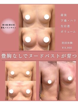 ラヴィス(RAVIS)/バストのお悩み改善◎