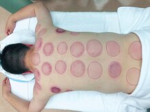 たくみ整体院/【竹吸玉】施術における残色色体