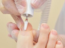 ペディケア 横浜本店/トラブル爪ケア：巻爪ケア