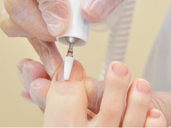 ペディケア 横浜本店/トラブル爪ケア:巻爪ケア